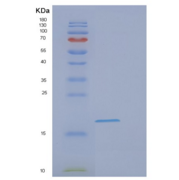 人EIF1AX重组蛋白