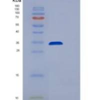 人真核翻译延伸因子2(EEF2)重组蛋白