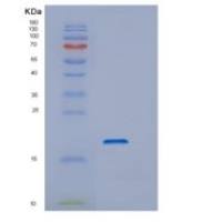 人解聚蛋白(DSTN)重组蛋白