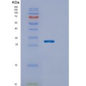 人含烯酰辅酶A水合酶短链1(ECHS1)重组蛋白