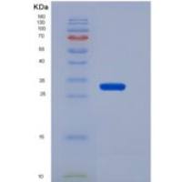人电子转移黄素蛋白β肽(ETFb)重组蛋白