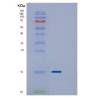 人DYNLT3重组蛋白