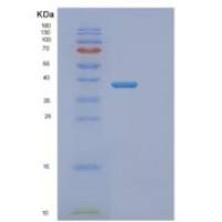 人DNTTIP1重组蛋白