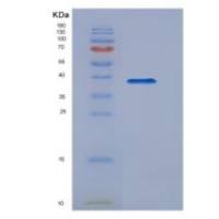 小鼠表皮生长因子(EGF)重组蛋白