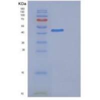 人EPHX1重组蛋白