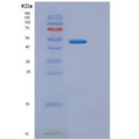 人三磷酸胞苷二磷酸水解酶3(ENTPD3)重组蛋白