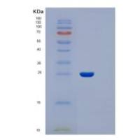 FIMC大肠杆菌重组蛋白