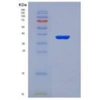 人真核延伸因子2激酶(EEF2K)重组蛋白