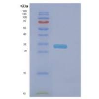 人DNAJC27重组蛋白