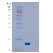人动力蛋白轻链LC8型2(DYNLL2)重组蛋白