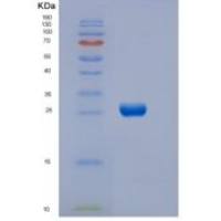 人脱氧胸苷酸激酶(DTYMK)重组蛋白