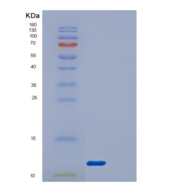 人DYNLRB1重组蛋白