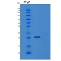 人SiSo细胞上表达的受体结合癌抗原（EBAG9）重组蛋白