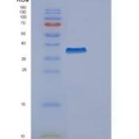 人内质网脂质Raft关联蛋白2(ERLIN2)重组蛋白