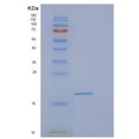 人EIF1AX重组蛋白