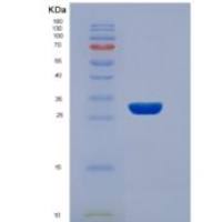 人真核翻译延伸因子1β2(EEF1b2)重组蛋白