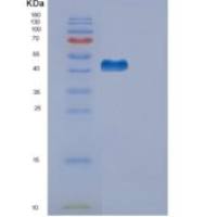 人外异蛋白A2受体(EDA2R)重组蛋白