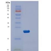 人双特异性磷酸酶3(DUSP3)重组蛋白