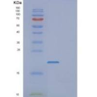 人发育全能关联蛋白3(DPPA3)重组蛋白