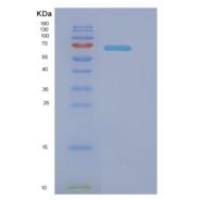 大肠杆菌Dnak(全长;1-638)重组蛋白