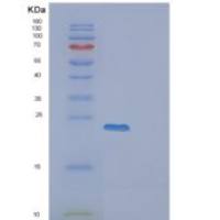 人EXOSC1重组蛋白