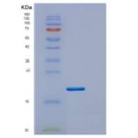 大肠杆菌DsbE重组蛋白