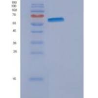 人内皮糖蛋白(ENG)重组蛋白