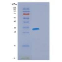 人ENOPH1重组蛋白