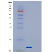 人DYNLRB1重组蛋白
