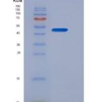 人红细胞生成素(EPO)重组蛋白