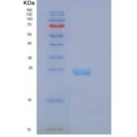 人肝配蛋白B2(EFNB2)重组蛋白