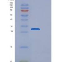人ECI1重组蛋白