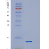 人DSCR1异构体b重组蛋白