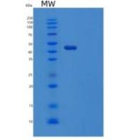 人肝配蛋白A5(EFNA5)重组蛋白