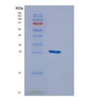 人DUSP26重组蛋白