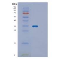 人ECHDC1重组蛋白