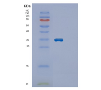 人ECHDC1重组蛋白