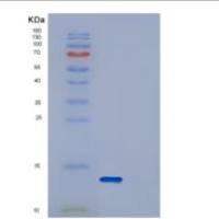 人DYNLRB2重组蛋白