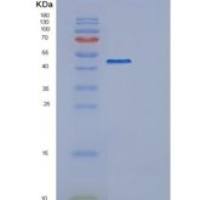 人内质网蛋白44(ERP44)重组蛋白