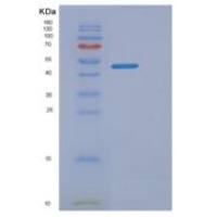 人三磷酸胞苷二磷酸水解酶6(ENTPD6)重组蛋白