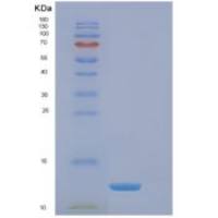 人真核翻译起始因子4E结合蛋白3(EIF4EBP3)重组蛋白