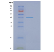 人真核翻译起始因子3F(EIF3F)重组蛋白