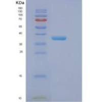 人真核翻译起始因子2亚基1(EIF2S1)重组蛋白