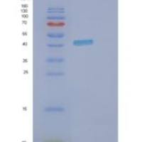 人DNMT3L重组蛋白