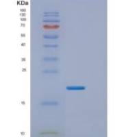 人内皮细胞特异分子1(ESM1)重组蛋白