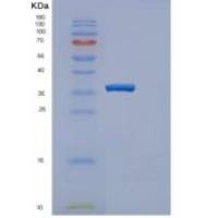 人雌激素磺基转移酶重组蛋白