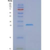 人EIF4E重组蛋白