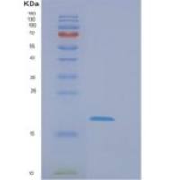 人EIF5A2重组蛋白