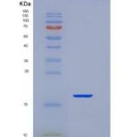 人表皮生长因子(EGF)重组蛋白