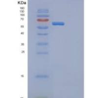 小鼠Ephb4重组蛋白